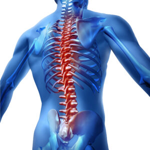 Spinal Cord Stimulator Implant in Plano, Frisco, McKinney and Allen